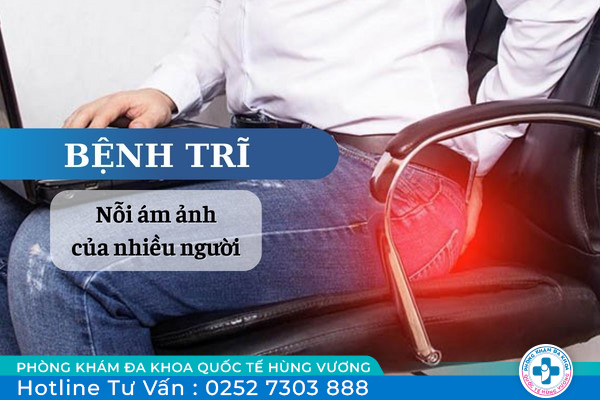 Bệnh trĩ là gì? Nguyên nhân, dấu hiệu và cách chữa