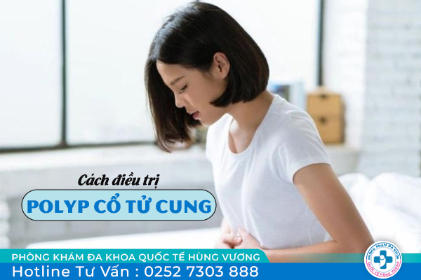 Cách điều trị polyp cổ tử cung hiện nay