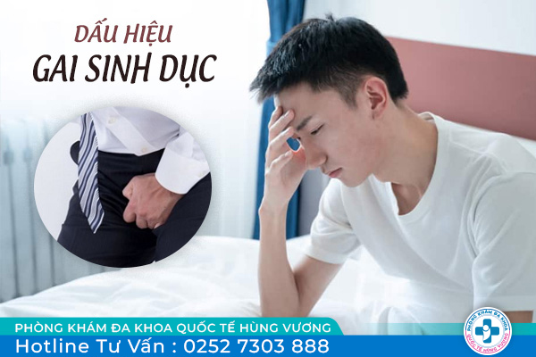 Một số triệu chứng gai sinh dục dễ nhận biết
