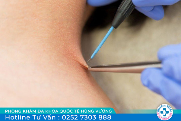 Phòng Khám Đa Khoa Quốc Tế Hùng Vương