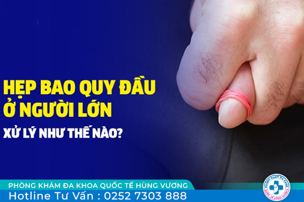 Bao quy đầu hẹp có cần phải làm phẫu thuật không?