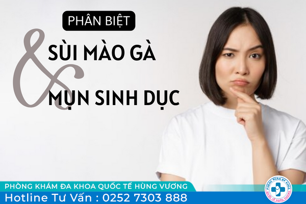 Phân biệt mụn sinh dục và sùi mào gà