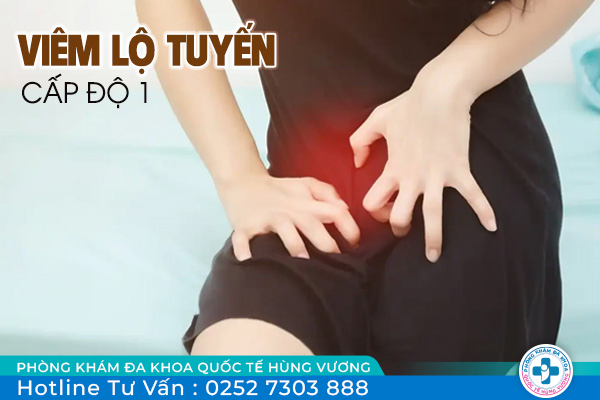 Phương pháp điều trị viêm lộ tuyển cấp độ 1 hiệu quả