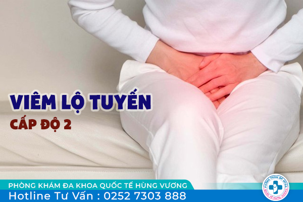 Biểu hiện của viêm lộ tuyến cấp độ 2